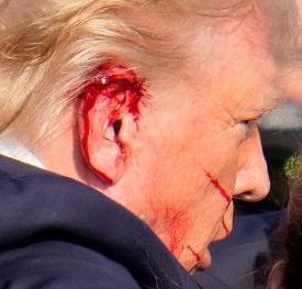 bloody ear